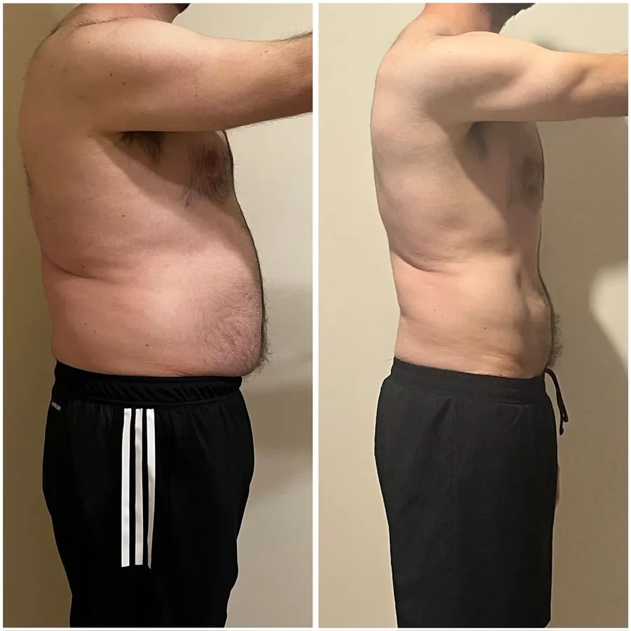 Antes y después de un cliente que perdió 12 kg