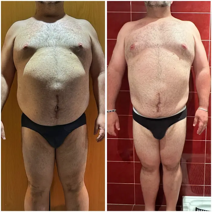 Antes y después de un cliente del programa