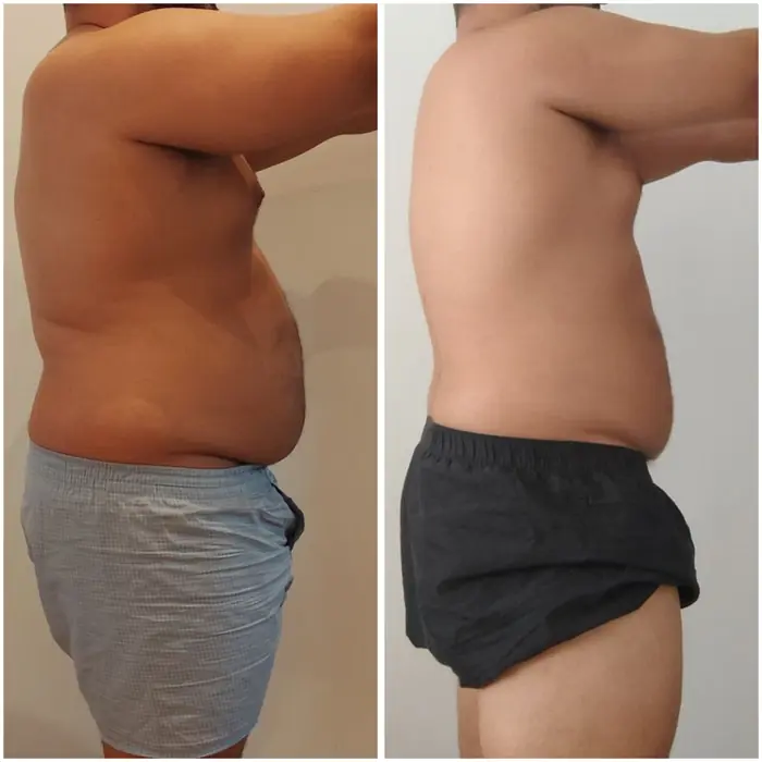 Antes y después de un cliente del programa