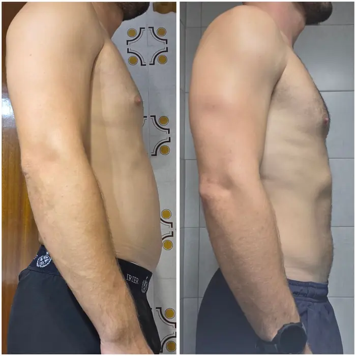 Antes y después de un cliente del programa